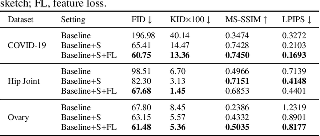 Figure 2 for Sketch guided and progressive growing GAN for realistic and editable ultrasound image synthesis