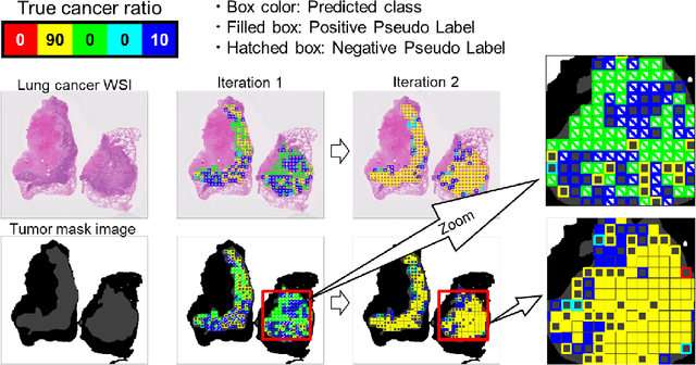 Figure 3 for Negative Pseudo Labeling using Class Proportion for Semantic Segmentation in Pathology