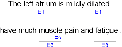 Figure 1 for An Effective Transition-based Model for Discontinuous NER