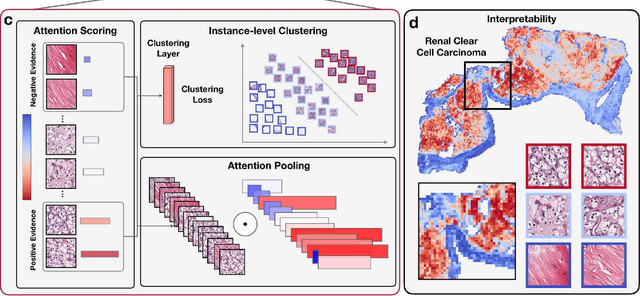 Figure 1 for Data Efficient and Weakly Supervised Computational Pathology on Whole Slide Images