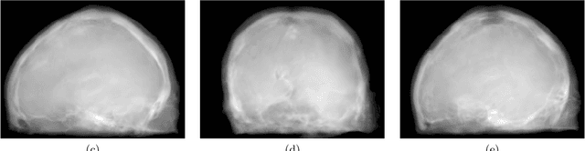 Figure 3 for Projection image-to-image translation in hybrid X-ray/MR imaging