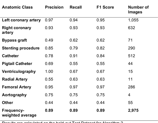 Figure 1 for CathAI: Fully Automated Interpretation of Coronary Angiograms Using Neural Networks