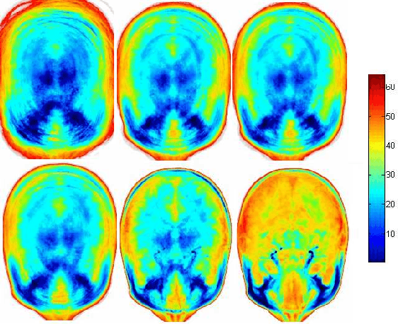 Figure 3 for Fully Automatic 3D Reconstruction of Histological Images
