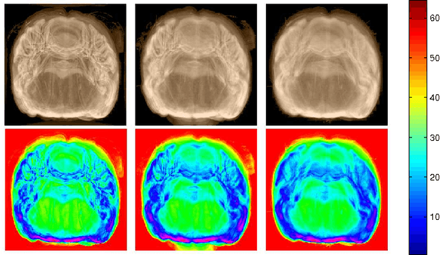 Figure 4 for Fully Automatic 3D Reconstruction of Histological Images