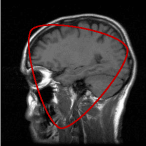Figure 2 for The Chan-Vese Algorithm