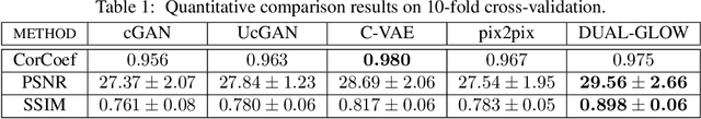 Figure 2 for DUAL-GLOW: Conditional Flow-Based Generative Model for Modality Transfer