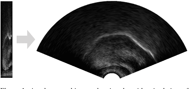 Figure 2 for UltraSuite: A Repository of Ultrasound and Acoustic Data from Child Speech Therapy Sessions