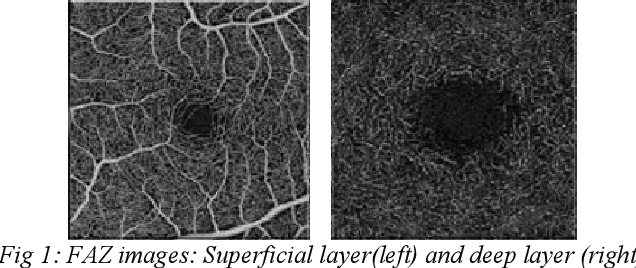 Figure 1 for FAZSeg: A New User-Friendly Software for Quantification of the Foveal Avascular Zone