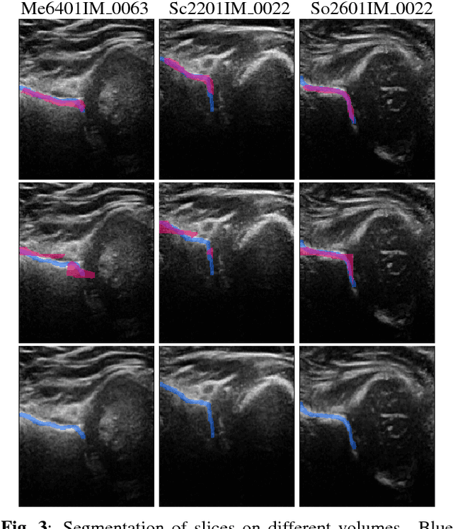 Figure 3 for End-to-end detection-segmentation network with ROI convolution