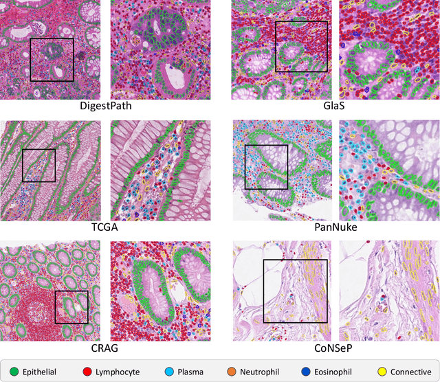 Figure 3 for Lizard: A Large-Scale Dataset for Colonic Nuclear Instance Segmentation and Classification