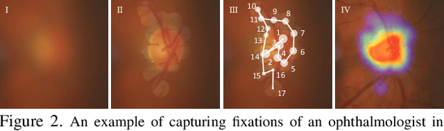 Figure 3 for Attention Based Glaucoma Detection: A Large-scale Database and CNN Model
