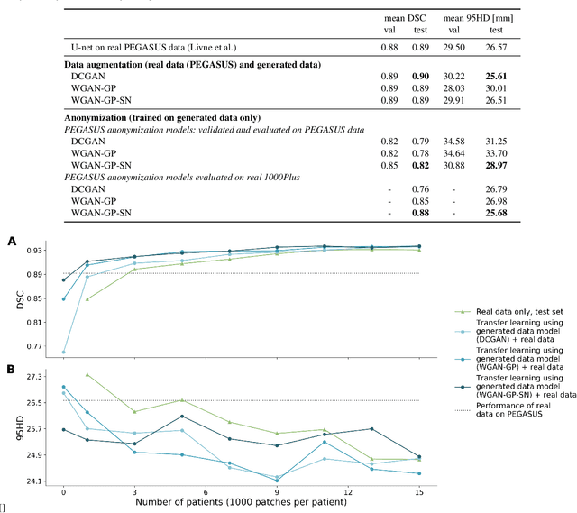 Figure 4 for Anonymization of labeled TOF-MRA images for brain vessel segmentation using generative adversarial networks