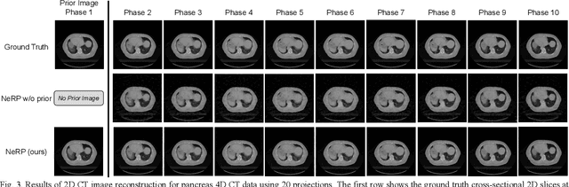 Figure 3 for NeRP: Implicit Neural Representation Learning with Prior Embedding for Sparsely Sampled Image Reconstruction