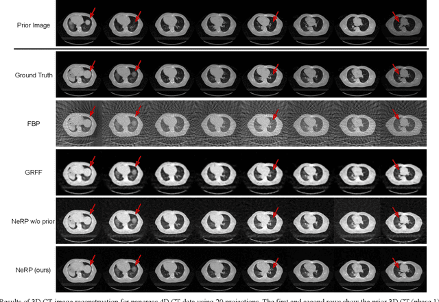 Figure 4 for NeRP: Implicit Neural Representation Learning with Prior Embedding for Sparsely Sampled Image Reconstruction