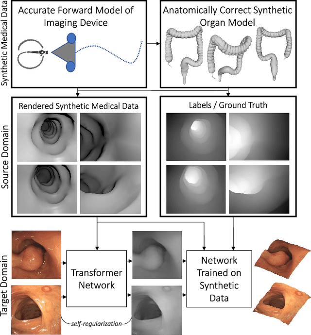 Figure 1 for Unsupervised Reverse Domain Adaptation for Synthetic Medical Images via Adversarial Training