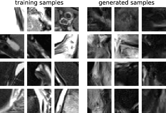 Figure 2 for Ultrasound Speckle Suppression and Denoising using MRI-derived Normalizing Flow Priors