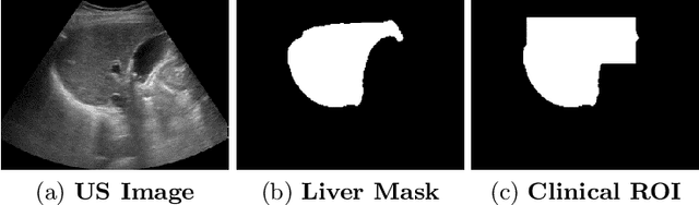 Figure 3 for Reliable Liver Fibrosis Assessment from Ultrasound using Global Hetero-Image Fusion and View-Specific Parameterization