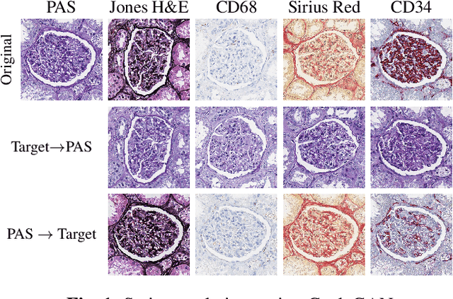Figure 2 for Towards Measuring Domain Shift in Histopathological Stain Translation in an Unsupervised Manner