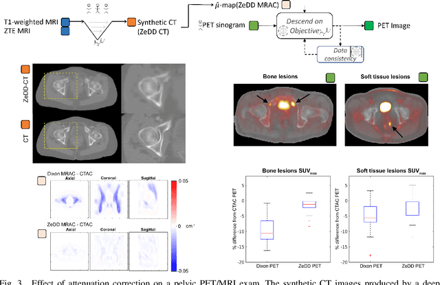 Figure 3 for Physics-driven Deep Learning for PET/MRI