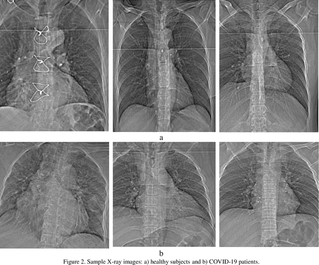 Figure 3 for Fusion of convolution neural network, support vector machine and Sobel filter for accurate detection of COVID-19 patients using X-ray images