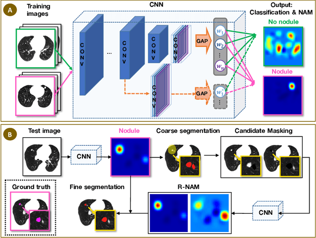 Figure 1 for Discriminative Localization in CNNs for Weakly-Supervised Segmentation of Pulmonary Nodules