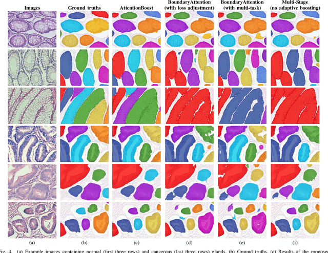 Figure 4 for AttentionBoost: Learning What to Attend by Boosting Fully Convolutional Networks