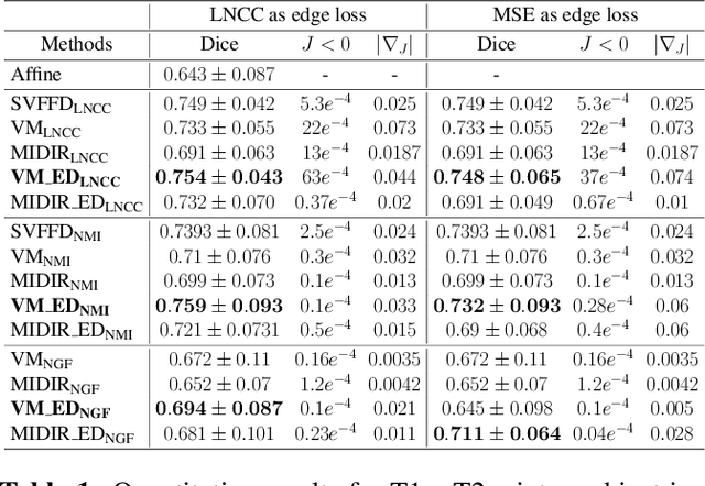 Figure 2 for Multi-modal unsupervised brain image registration using edge maps