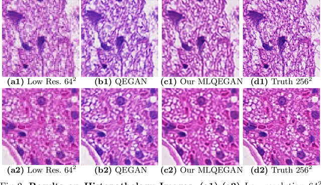 Figure 2 for A Mixed-Supervision Multilevel GAN Framework for Image Quality Enhancement