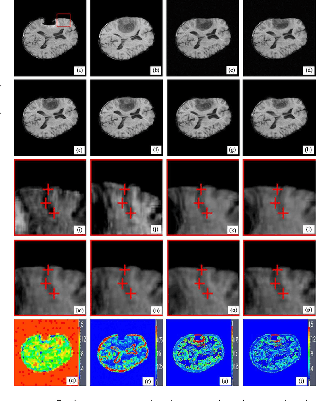Figure 3 for Scale Selection of Adaptive Kernel Regression by Joint Saliency Map for Nonrigid Image Registration