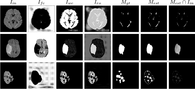 Figure 4 for ASC-Net : Adversarial-based Selective Network for Unsupervised Anomaly Segmentation