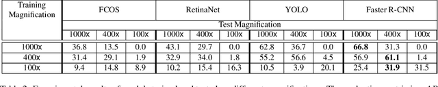 Figure 4 for Towards Low-Cost and Efficient Malaria Detection