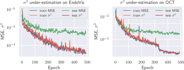 Figure 3 for Recalibration of Aleatoric and Epistemic Regression Uncertainty in Medical Imaging