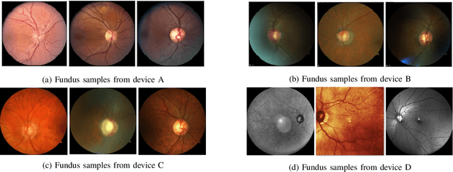 Figure 3 for Real-World Multi-Domain Data Applications for Generalizations to Clinical Settings