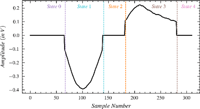 Figure 2 for Real-Time Detection of Drowsiness Among Vehicle Drivers: A Machine Learning Algorithm for Embedded Systems