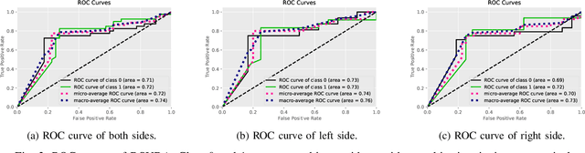 Figure 3 for Disentangled and Side-aware Unsupervised Domain Adaptation for Cross-dataset Subjective Tinnitus Diagnosis