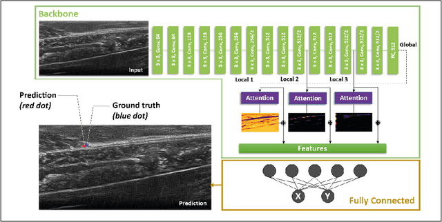 Figure 1 for Automatic Tracking of the Muscle Tendon Junction in Healthy and Impaired Subjects using Deep Learning