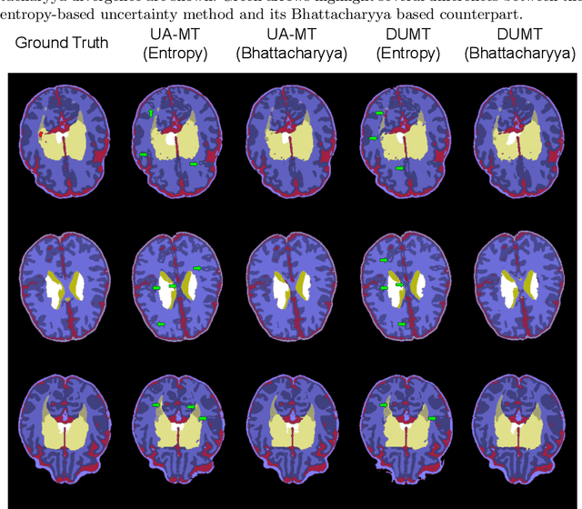 Figure 4 for On the pitfalls of entropy-based uncertainty for multi-class semi-supervised segmentation