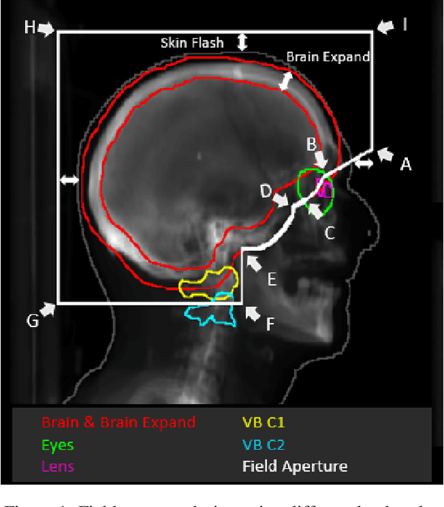 Figure 1 for Automated WBRT Treatment Planning via Deep Learning Auto-Contouring and Customizable Landmark-Based Field Aperture Design