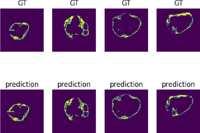 Figure 4 for Epicardial Adipose Tissue Segmentation from CT Images with A Semi-3D Neural Network