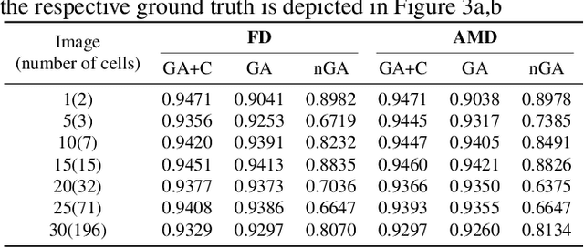 Figure 2 for A hybrid multi-object segmentation framework with model-based B-splines for microbial single cell analysis