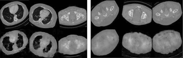 Figure 4 for Equivariant Priors for Compressed Sensing with Unknown Orientation