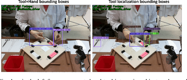 Figure 1 for Video-based fully automatic assessment of open surgery suturing skills