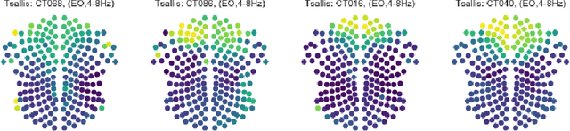 Figure 1 for Computational EEG in Personalized Medicine: A study in Parkinson's Disease
