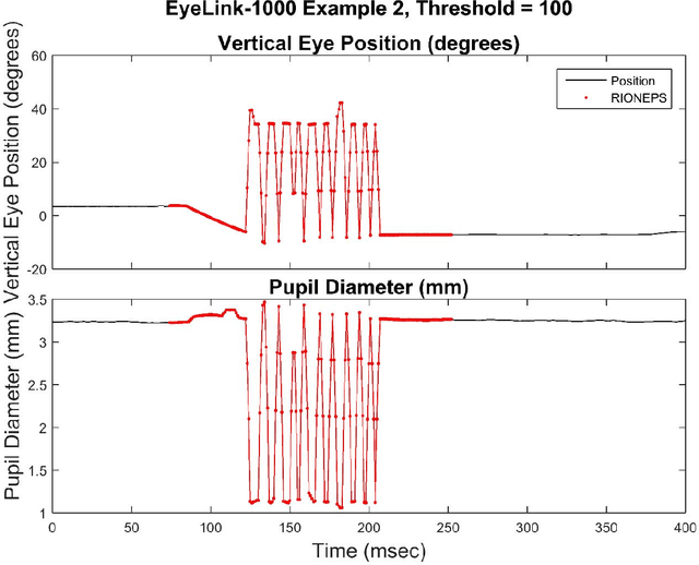 Figure 2 for Method to Detect Eye Position Noise from Video-Oculography when Detection of Pupil or Corneal Reflection Position Fails