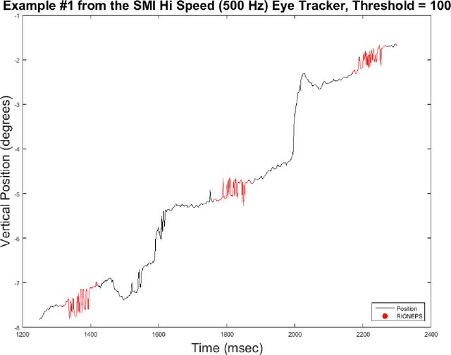 Figure 3 for Method to Detect Eye Position Noise from Video-Oculography when Detection of Pupil or Corneal Reflection Position Fails