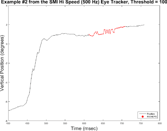 Figure 4 for Method to Detect Eye Position Noise from Video-Oculography when Detection of Pupil or Corneal Reflection Position Fails