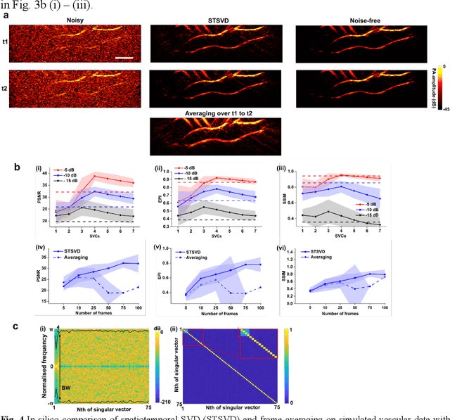 Figure 4 for Spatiotemporal singular value decomposition for denoising in photoacoustic imaging with low-energy excitation light source