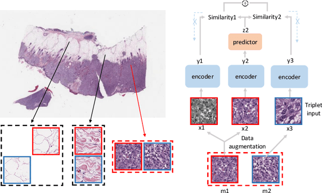 Figure 3 for SimTriplet: Simple Triplet Representation Learning with a Single GPU
