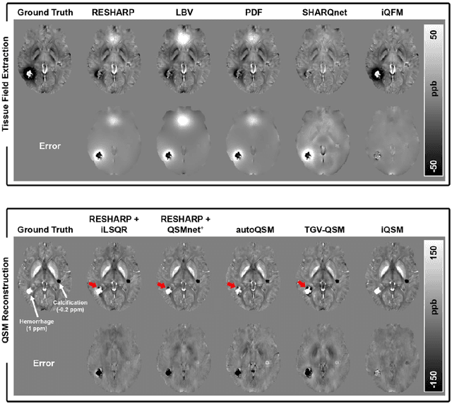 Figure 3 for Instant tissue field and magnetic susceptibility mapping from MR raw phase using Laplacian enabled deep neural networks