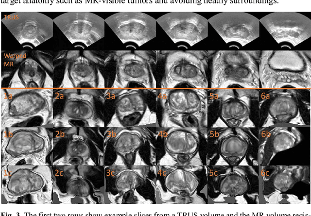 Figure 3 for Adversarial Deformation Regularization for Training Image Registration Neural Networks